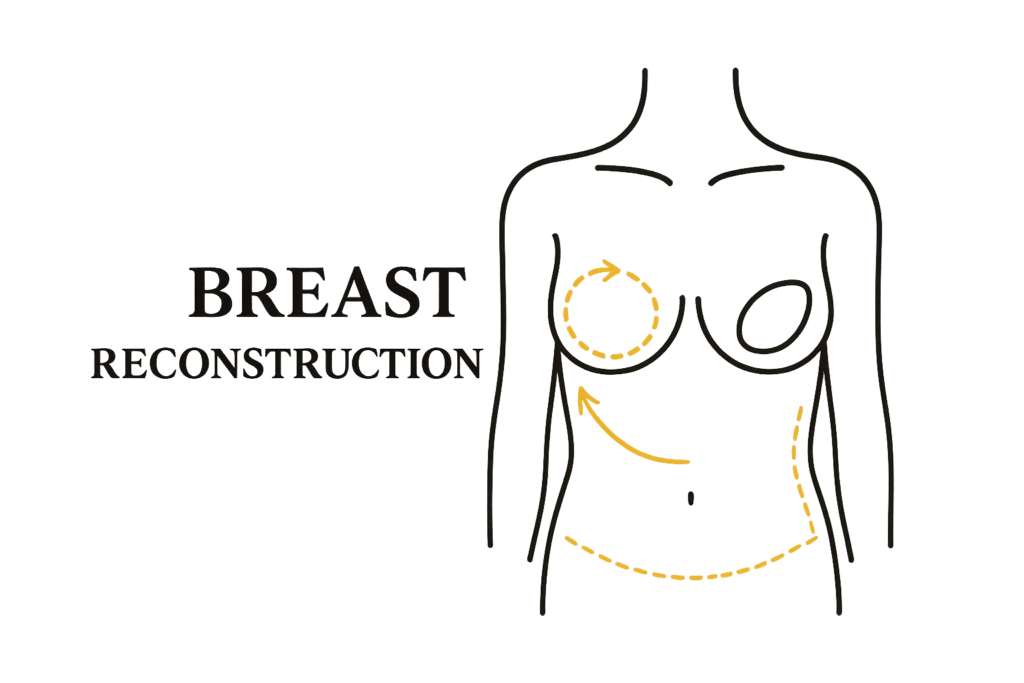 breast reconstruction png